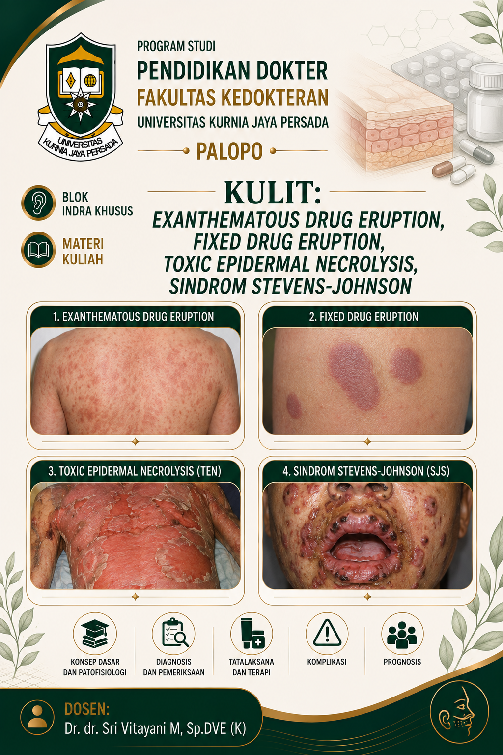 Exanthematous drug eruption, fixed drug eruption, Toxic epidermal necrolysis, Sindrom Stevens-Johnson 