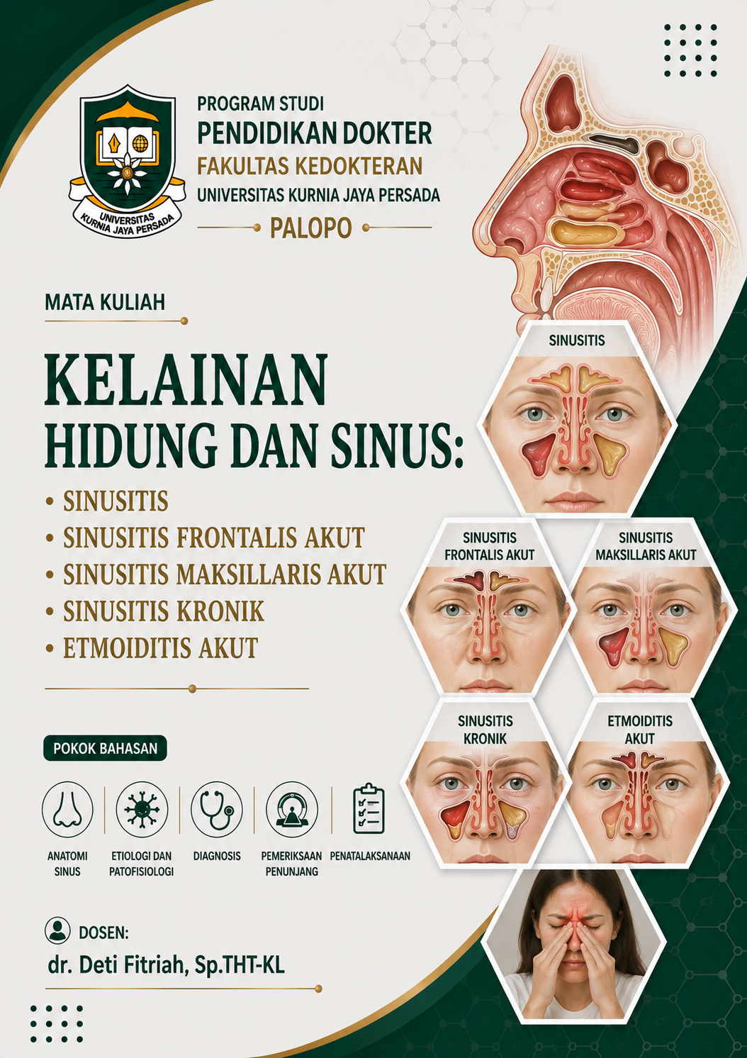Kelainan Hidung Dan Sinus: Sinusitis, Sinusitis Frontalis Akut, Sinusitis Maksillaris Akut, Sinusitis Kronik, Etmoiditis Akut