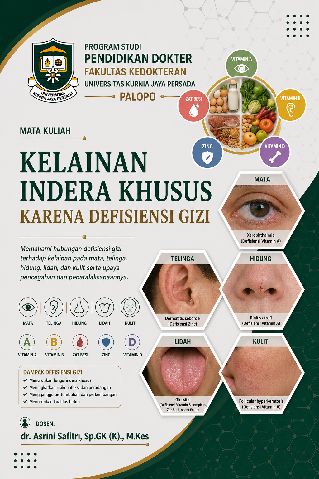 Kelainan Indera Khusus karena Defisiensi Gizi 